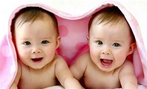 Anak Kembar: Keunikan, Jenis, dan Kehidupan Mereka